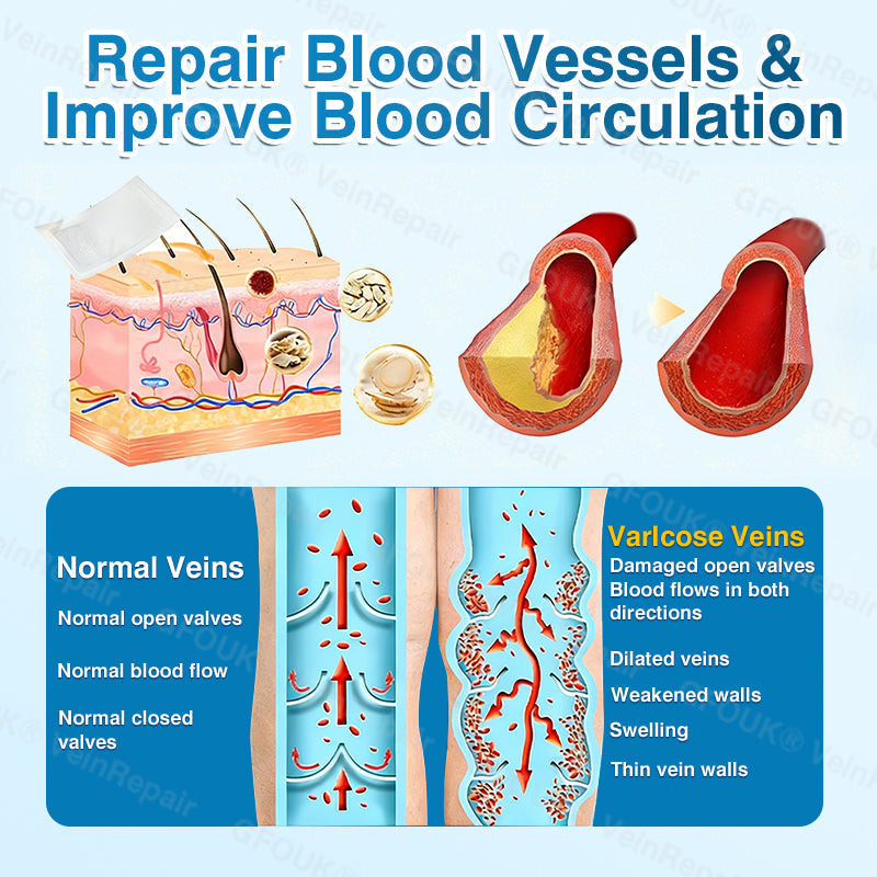 🇬🇧🏆🦵🛡️GFOUK® VeinRepair Microneedle Patch Roll⚡Instant Relief, Long-Term Results