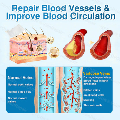 🇬🇧🏆🦵🛡️GFOUK® VeinRepair Microneedle Patch Roll⚡Instant Relief, Long-Term Results