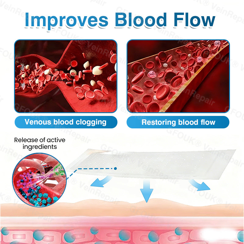 🇬🇧🏆🦵🛡️GFOUK® VeinRepair Microneedle Patch Roll⚡Instant Relief, Long-Term Results