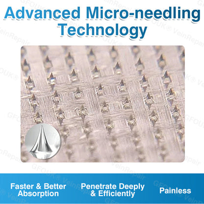 🇬🇧🏆🦵🛡️GFOUK® VeinRepair Microneedle Patch Roll⚡Instant Relief, Long-Term Results
