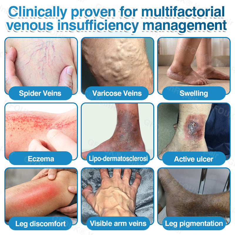 🇬🇧🏆🦵🛡️GFOUK® VeinRepair Microneedle Patch Roll⚡Instant Relief, Long-Term Results